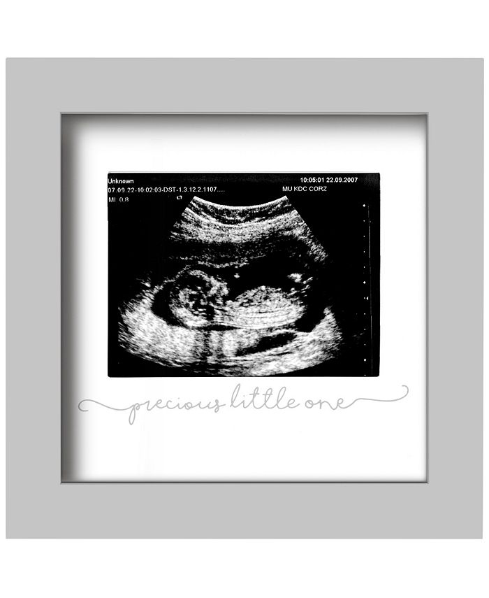 KeaBabies Baby Sonogram Picture Frame, Modern Ultrasound Frame