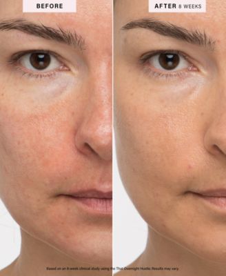 That Overnight Hustle AHA + BHA Resurfacer