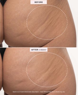 Tighten + Tease Resurfacing Body Serum