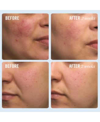 First Aid Beauty Ultra Repair Cream, 6-oz.