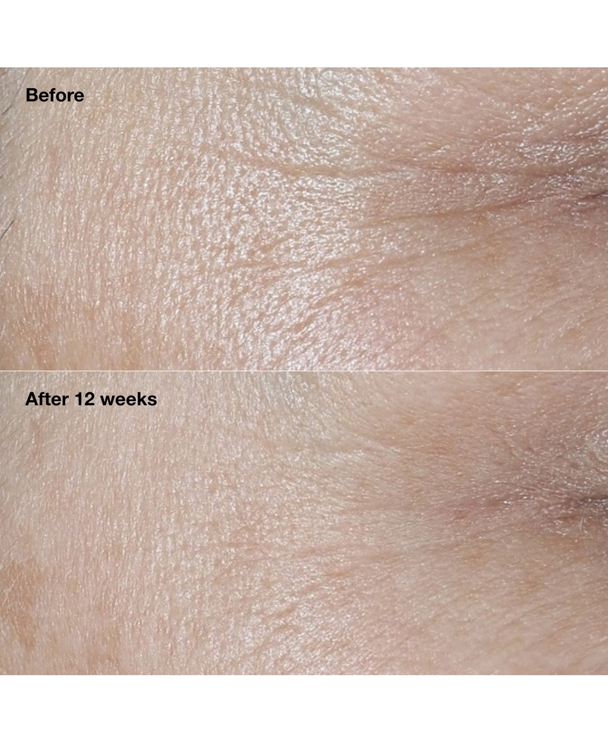 Clinique Smart Clinical Repair Wrinkle Correcting Cream Spf 30