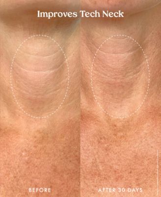 Ultra Renewal Retinol Body Cream, 4.7 oz.