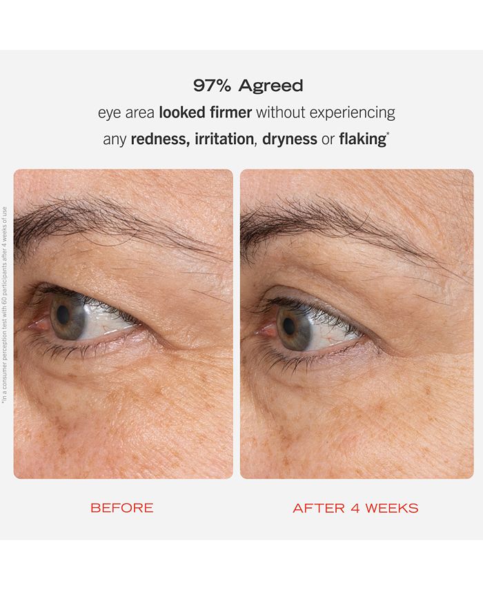 First Aid Beauty Retinol Eye Cream With Squalane + Ceramides, 0.5 oz