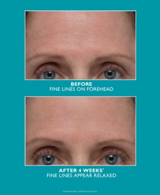 Peptide Skinjection&nbsp;Amplified Wrinkle-Fix Serum, 1 oz