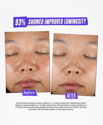 Dermatologist Solutions Clearly Corrective Dark Spot Solution, 3.8 oz.