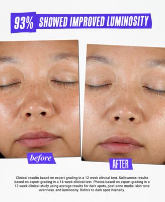 Dermatologist Solutions Clearly Corrective Dark Spot Solution, 3.4-oz.