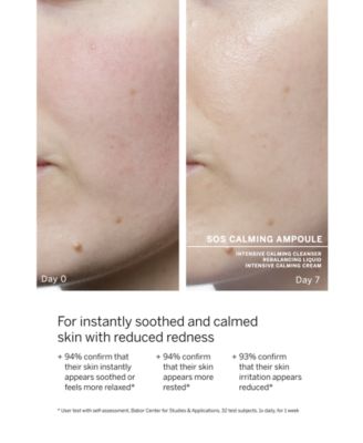 SOS Calming Ampoule Concentrates