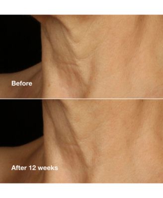 Smart Clinical Repair Lifting Face + Neck Cream, 1.7 oz.