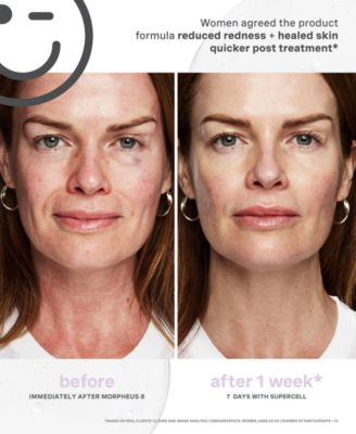 KateCeuticals SuperCell Rejuvenation Serum, 1 oz.