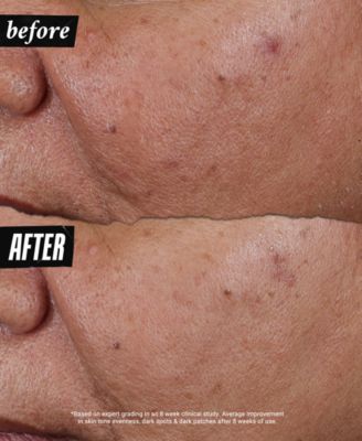 Auto-Tone Discoloration & UV Solution, 1.4 oz.