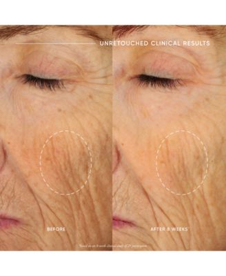 Ultimate Miracle Worker Nourish & Rejuvenate Face & Neck Cream