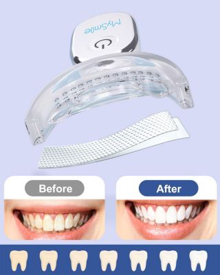 Teeth Whitening Kit with led Light, 28X Teeth Whitening Strips for Teeth Sensitive, 10 Min Fast Whitening , Helps to Remove Stains from Coffee, Smoking, Wines (1Pcs Light + 14Sets Strips)