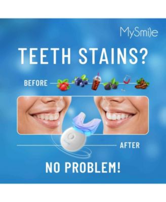 Teeth Whitening Kit with 5 LED Light, 10 Min Fast Teeth Whitener, 18% CP Teeth Whitening Gel