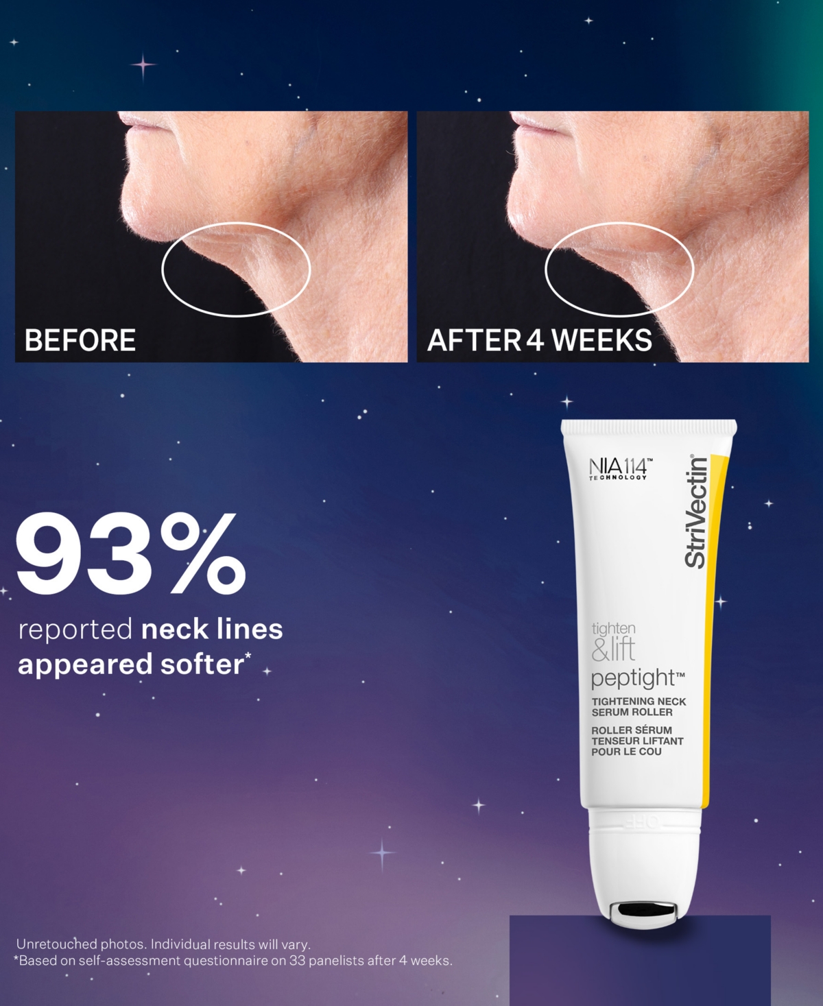 Strivectin 3-pc. Tighten, Smooth & Perfect Skincare Set, Created For Macy's In No Color