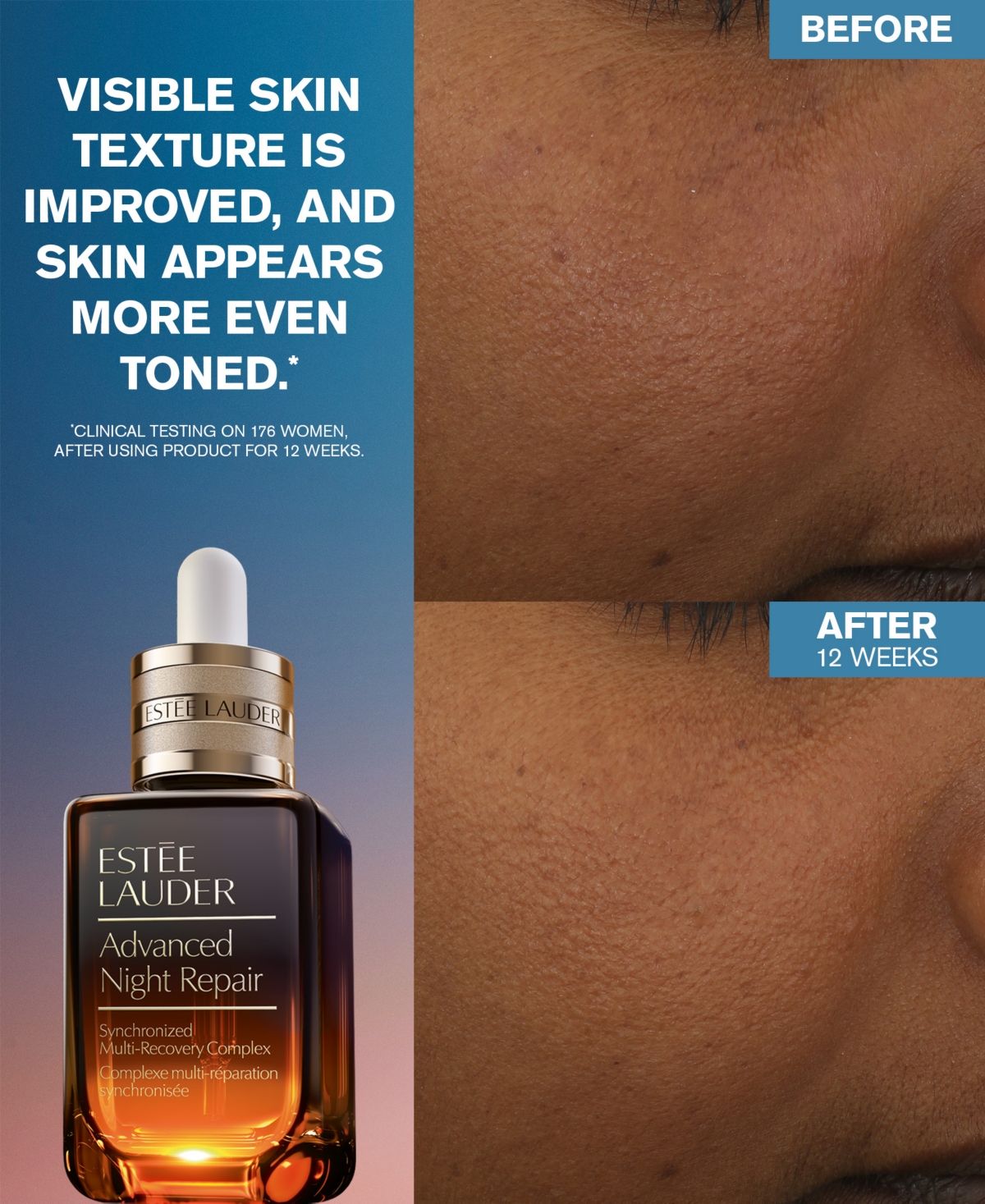 Estée Lauder Limited-edition Advanced Night Repair Serum In No Color
