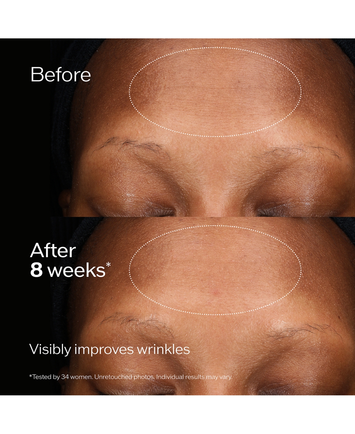 Shiseido Total Regenerating Cream In No Color