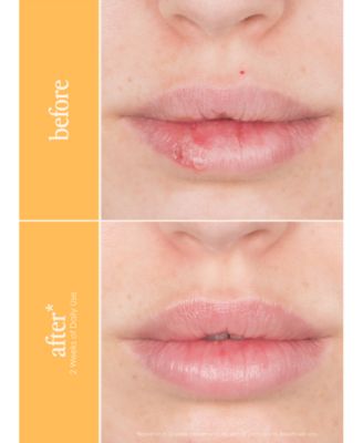 GrandePOUT Plumping Lip Mask - Berry Mojito