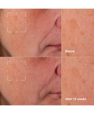 Even Better Clinical Dark Spot Clearing Serum with Vitamin C, 50 ml