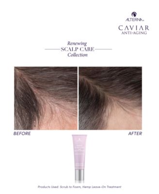 Renewing Scalp Care Hemp Leave-On Treatment, 2.5 oz.