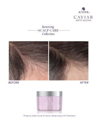 Renewing Scalp Care Scrub To Foam, 6 oz.