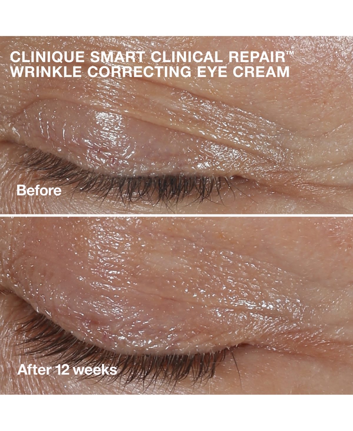 Shop Clinique 4-pc. Wrinkle-fighting Routine Skincare Set In No Color