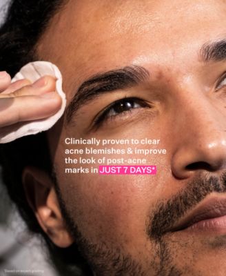 3-Pc. Acne Control Trial Set