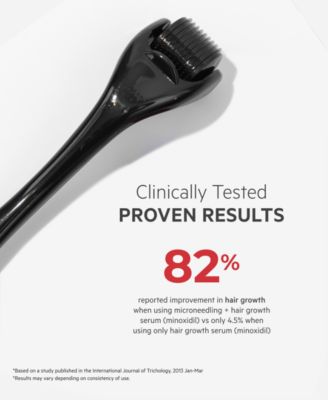 StimuROLLER+ Microneedle Hair Follicle Stimulation System, 1 mm