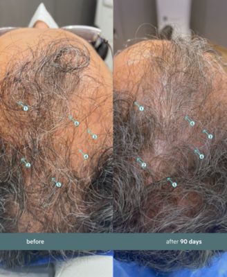 Spectral.F7 Booster With Astressin-B, 60 ml