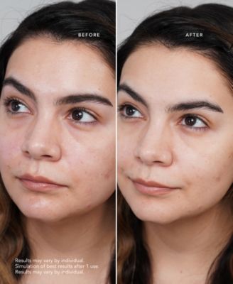 Facial Treatment Mask - 10 Sheets 