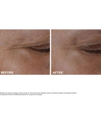 Total Eye Lift Eye Cream Refill for Firming, Wrinkles, Dark Circles & Puffiness, 0.5 oz.