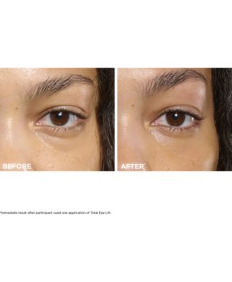 Total Eye Lift Eye Cream Refill for Firming, Wrinkles, Dark Circles & Puffiness, 0.5 oz.