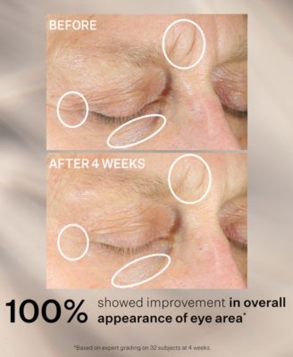 Anti-Wrinkle Intensive Eye Concentrate For Wrinkles Plus, 1-oz.