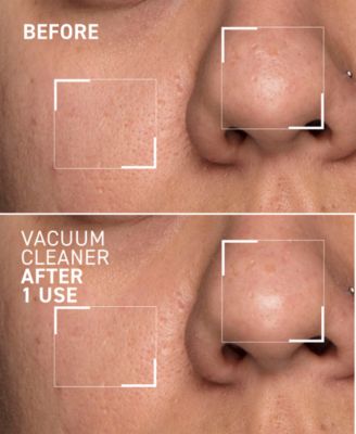 Pores No More Vacuum Cleaner Pore Purifying Mask, 1-oz.