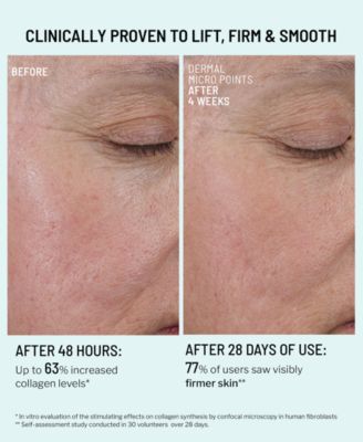 Dermal Micro Points Collagen Boosting Gel, 1 oz.