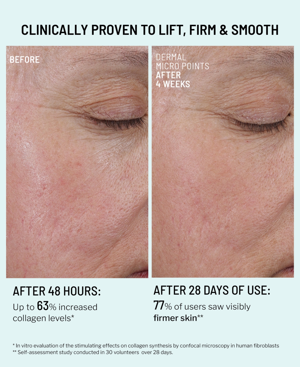 Dr. Brandt Dermal Micro Points Collagen Boosting Gel, 1 Oz. In Transparent