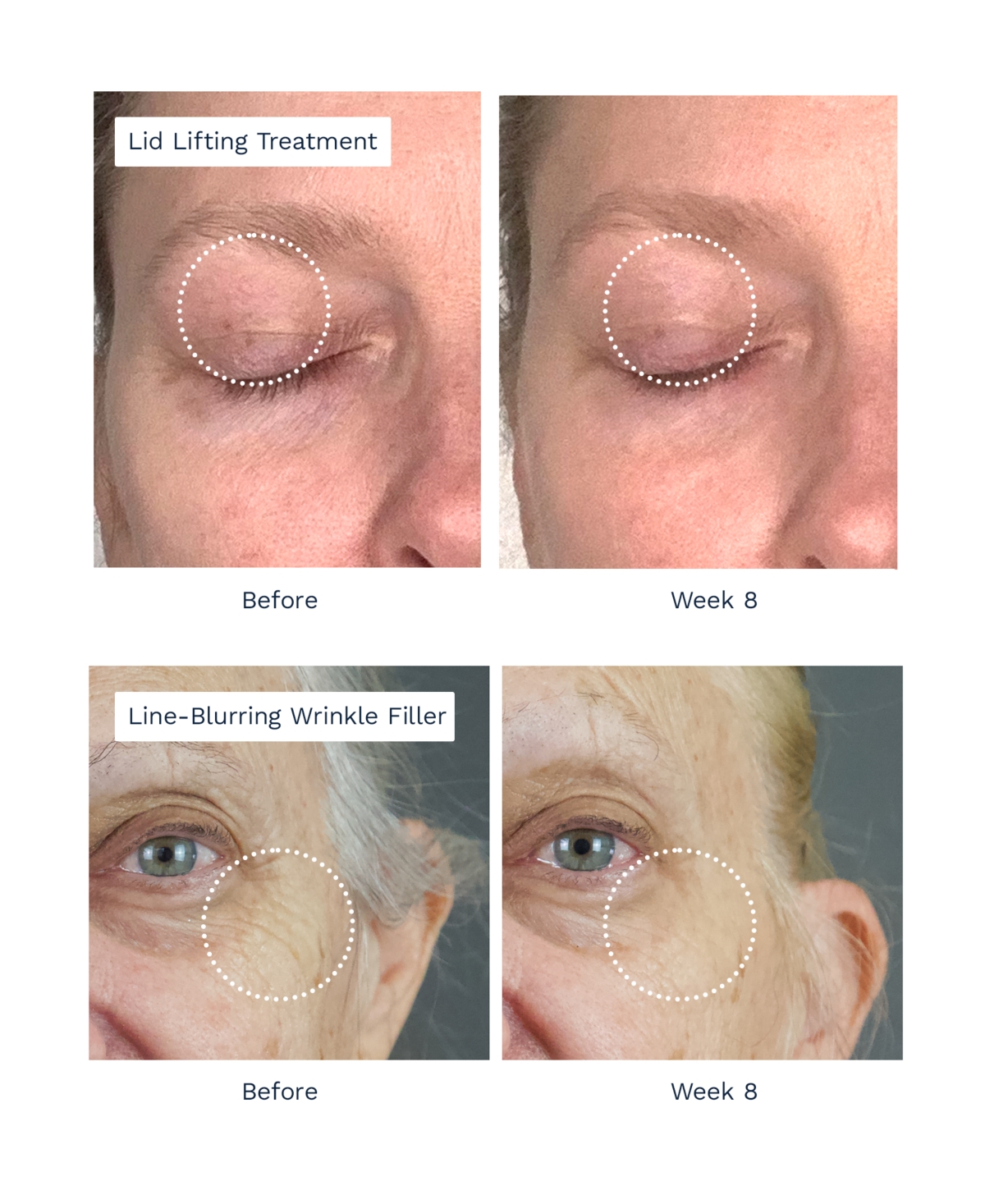 City Beauty Lift Lifting Treatment And Line Blurring Wrinkle Cream In Transparent