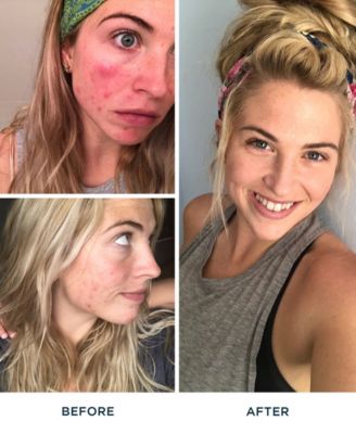 FR&Eacute; Detox Me Clearing Mask, 1.69oz.