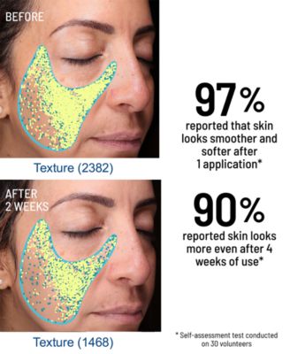 Advanced Microdermabrasion Face Exfoliator