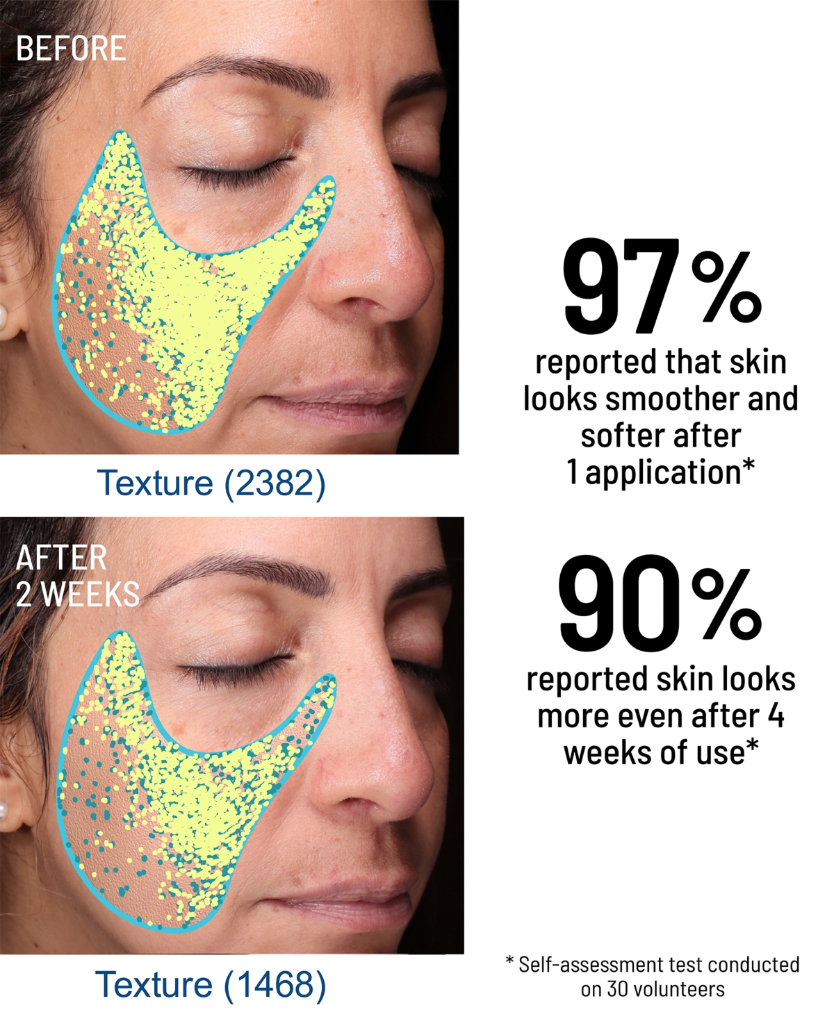 Dr. Brandt Advanced Microdermabrasion Face Exfoliator In Transparent