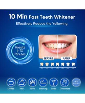 Everyday Smile Bundle - Water Flosser and Teeth Whitening Kit