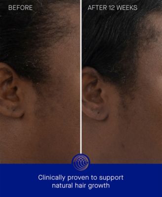 The Hair Scalp Treatment, 1.01 oz.