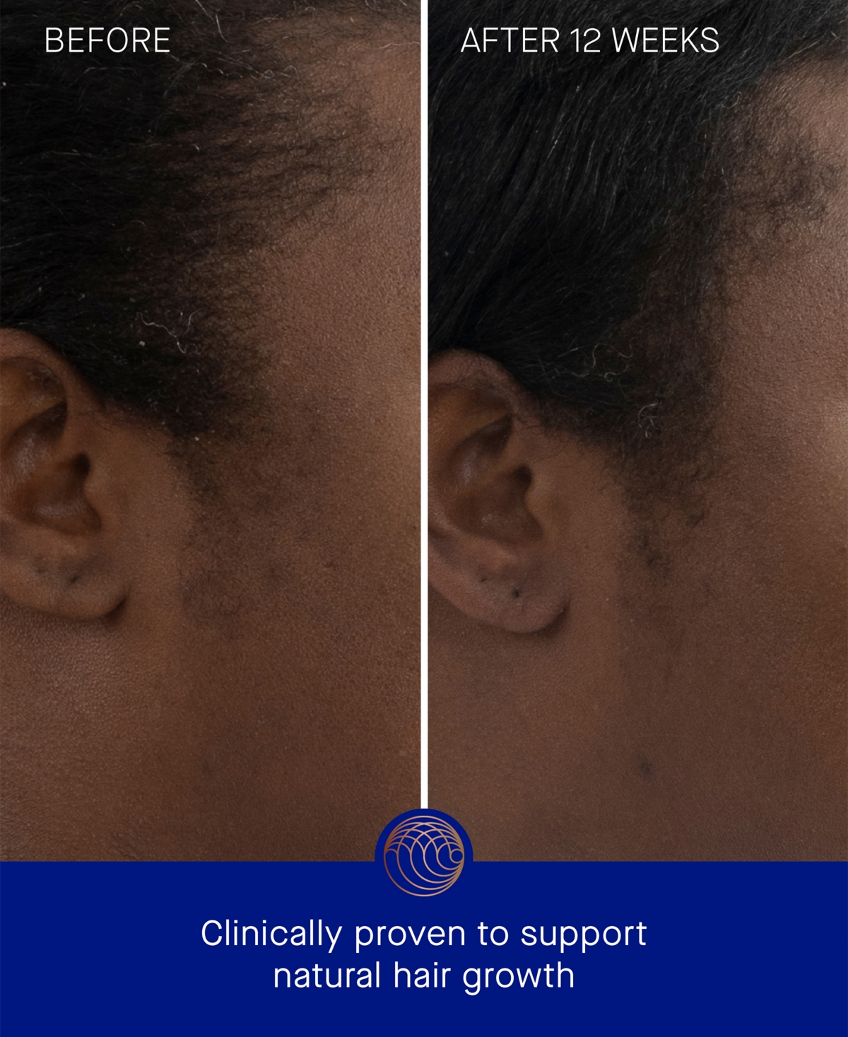 Augustinus Bader The Hair Scalp Treatment, 1.01 oz.