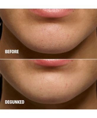 The POREfessional Degunker Blackhead and Pore Cleansing Mask System