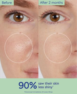 Vinopure Salicylic Acid Pore Minimizing Toner, 6.7 oz.