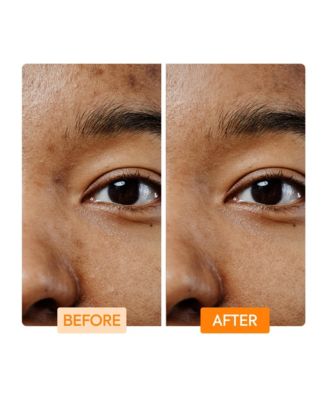 Vitamin C & Turmeric Facial Cleansing Bar - 7oz