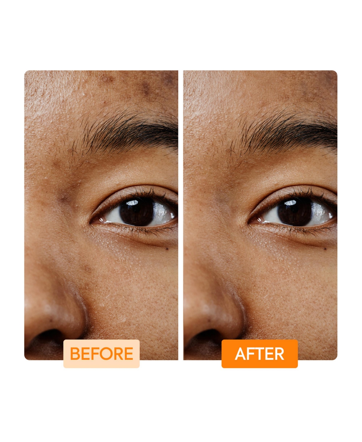 Makari Vitamin C & Turmeric Facial Cleansing Bar - 7oz