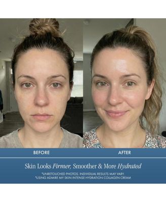 Intense Hydration Collagen Cream for Anti Aging Anti Wrinkle Cream