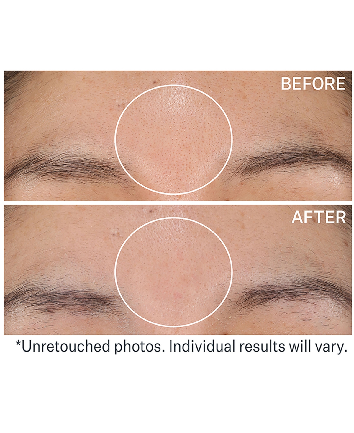 StriVectin Daily Reveal Exfoliating Pads, 60 pads