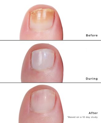 Mellow The Yellow Nail Brightening Treatment