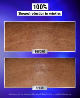 Retinol Fast Release Wrinkle-Reducing Night Serum, 0.94 oz.